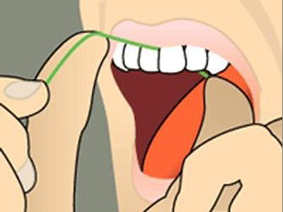 Close-up illustration of open mouth showing tongue and teeth for dental education purposes.